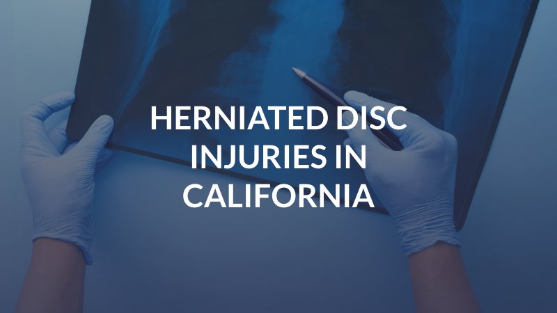 Herniated Disc Injuries in California